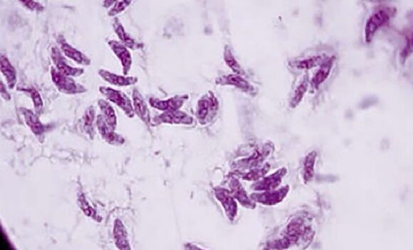 Το πρωτόζωο παράσιτο Toxoplasma gondii είναι ο αιτιολογικός παράγοντας της τοξοπλάσμωσης