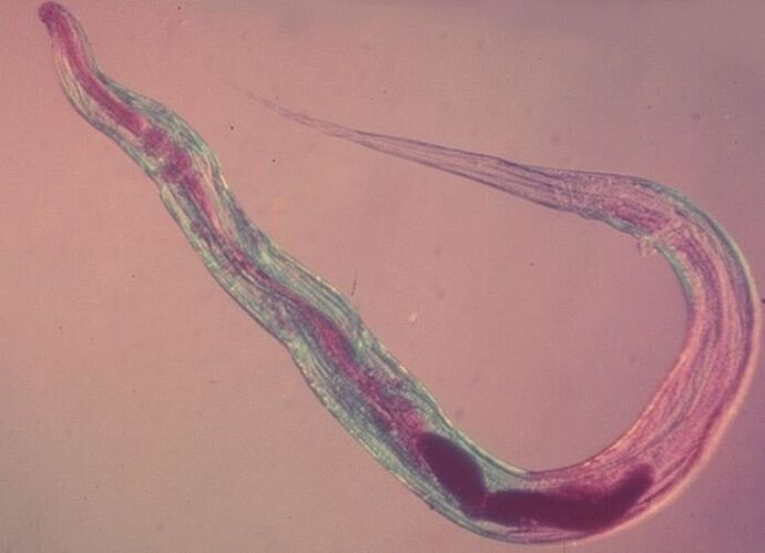 Pinworm κάτω από το μικροσκόπιο